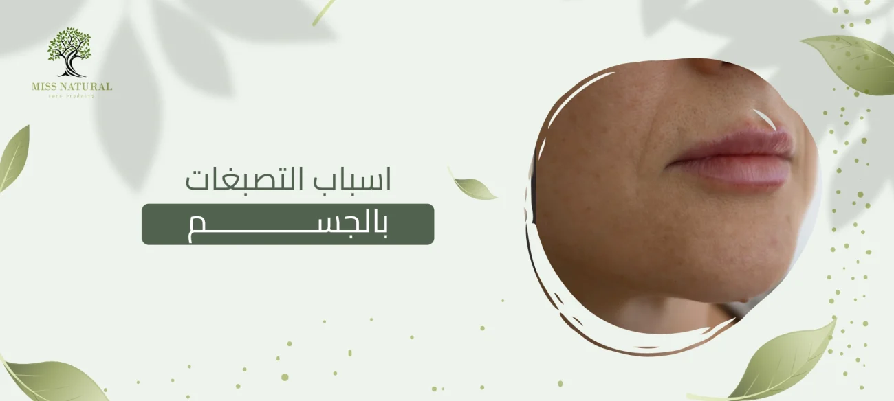 اسباب التصبغات بالجسم