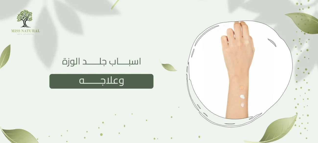 اسباب جلد الوزة وعلاجه